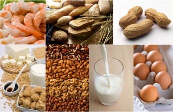 Common food allergies