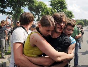 Injuired Russian LGBT activists